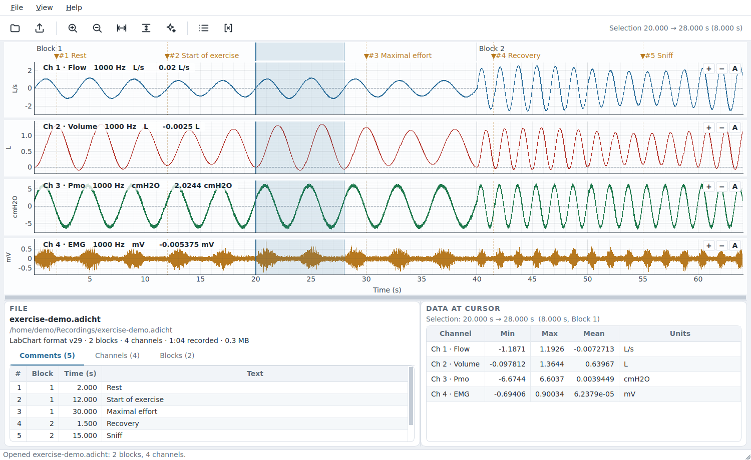The Adichtion window showing four channels (flow, volume, mouth pressure and EMG) over two blocks with comment flags, an eight-second interval selected within the first block, and a table of minimum, maximum and mean per channel for that interval.