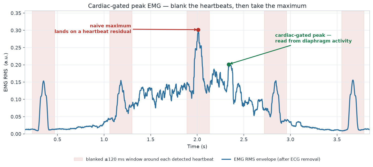 Rolling RMS envelope of a breath with gate windows blanked around each R-peak, contrasting the ungated maximum falling on a residual heartbeat with the gated maximum on diaphragm activity