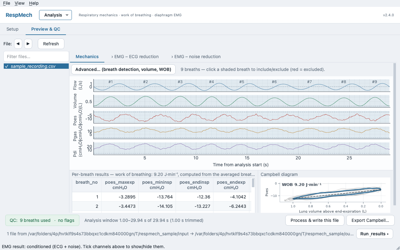 Preview Mechanics tab: flow, volume and pressure channels stacked on a shared time axis with numbered breath boundaries, a Campbell diagram and a per-breath metrics table below